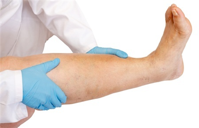 5-tips-atasi-kaki-bengkak-saat-hamil