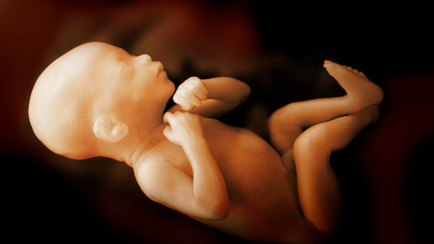 IUFD: Kondisi Janin Meninggal dalam Kandungan