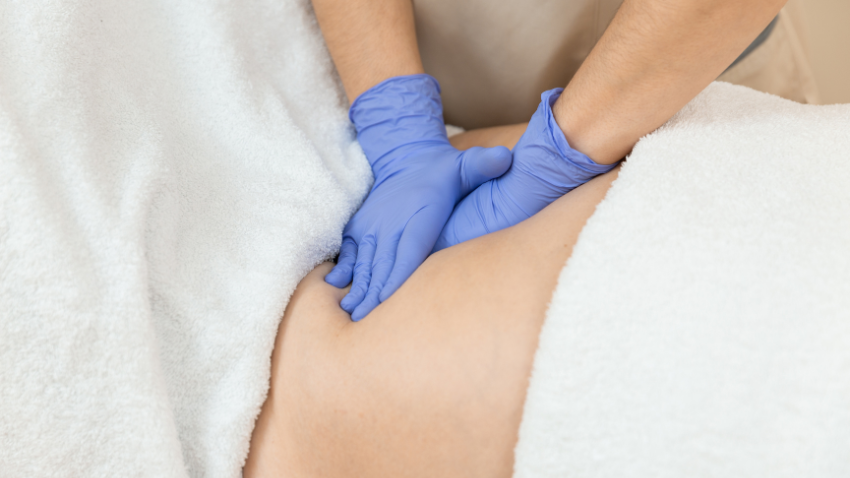 Diastasis Recti Ibu Nifas: Gejala, Penyebab & Penanganannya