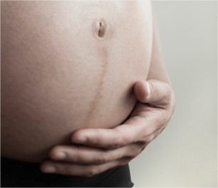 stretch-marks-di-saat-hamil