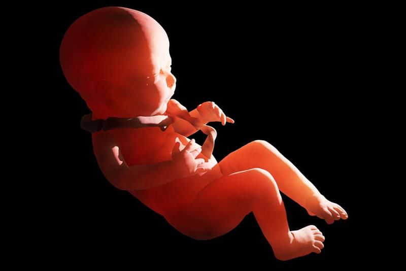 bayi-terlilit-tali-pusar-berbahayakah