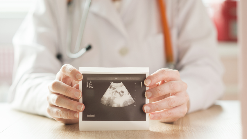 Biar Nggak Bingung, Begini Cara Membaca Hasil USG Kehamilan!