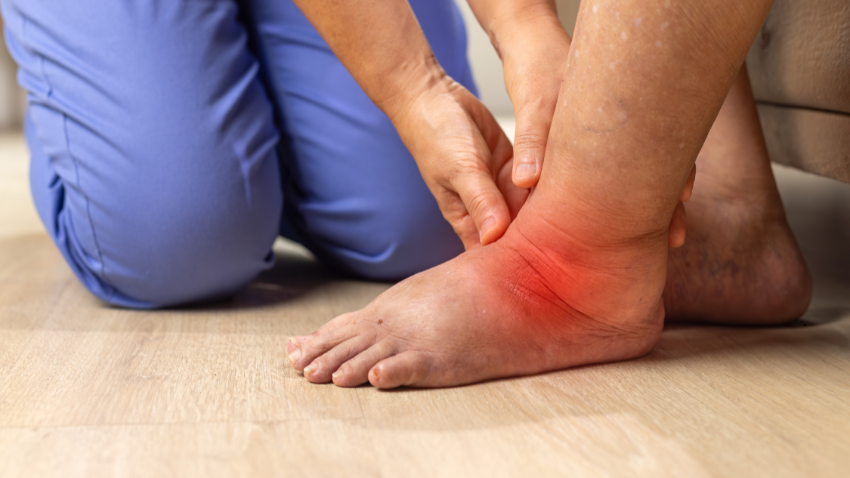 Penyebab Kaki Bengkak Setelah Melahirkan