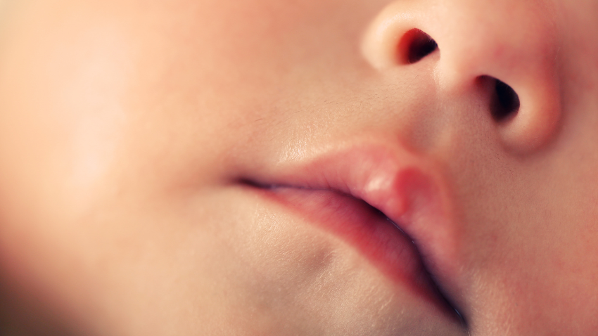 Hidung Tersumbat pada Bayi: Penyebab dan Cara Mengatasinya